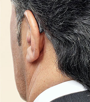 سمعک پشت گوشی